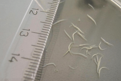 bagaimana untuk membuang pinworms daripada kanak-kanak
