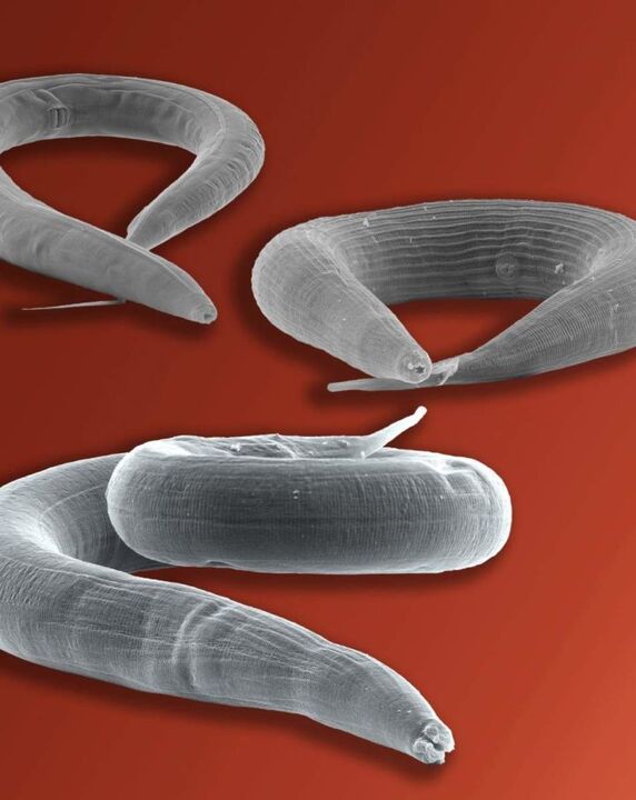 parasit pinworm yang tinggal di dalam usus