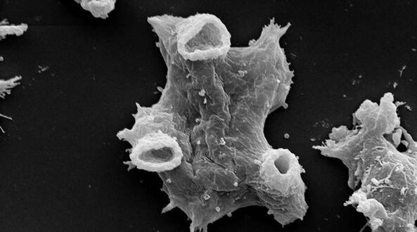 Negleria fowlera ialah parasit protozoa yang berbahaya kepada kehidupan manusia. 