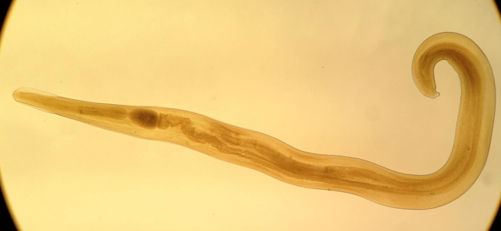 Pinworm adalah parasit biasa di kalangan kanak-kanak. 